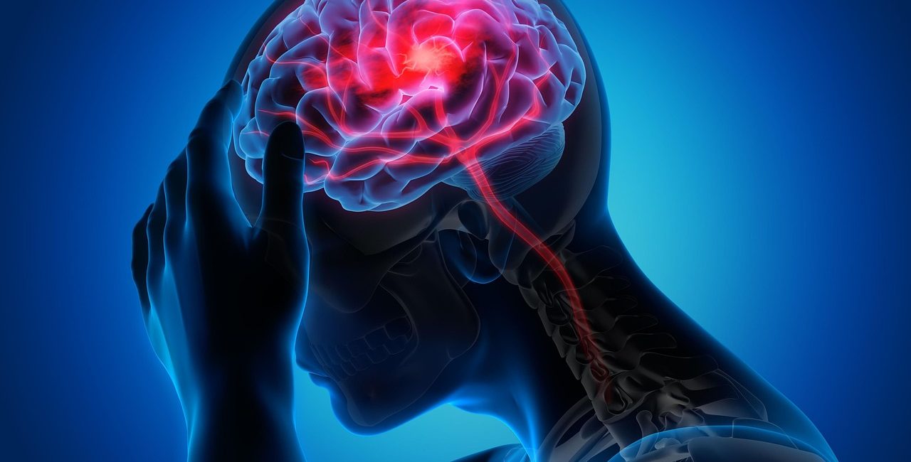 man, woman, migraine, healthcare, health, migraine, migraine, migraine, migraine, migraine
