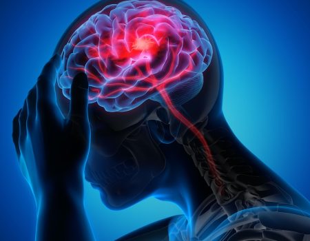 man, woman, migraine, healthcare, health, migraine, migraine, migraine, migraine, migraine