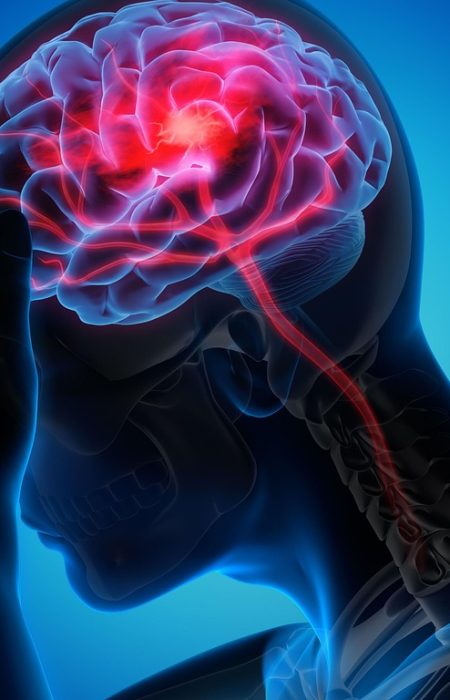 man, woman, migraine, healthcare, health, migraine, migraine, migraine, migraine, migraine